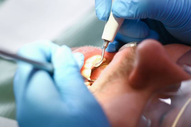 Best Emergency Wisdom Tooth Extraction in Mccrory, AR