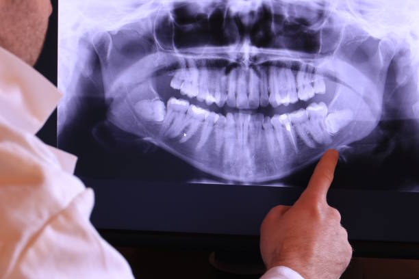 Best Emergency Dental Care for Sports Injuries in Mccrory, AR